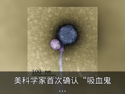 美科学家首次确认“吸血鬼病毒”存在